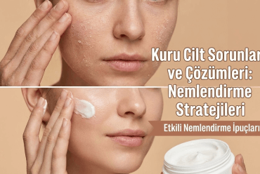 Kuru Cilt Sorunları ve Çözümleri: Nemlendirme Stratejileri